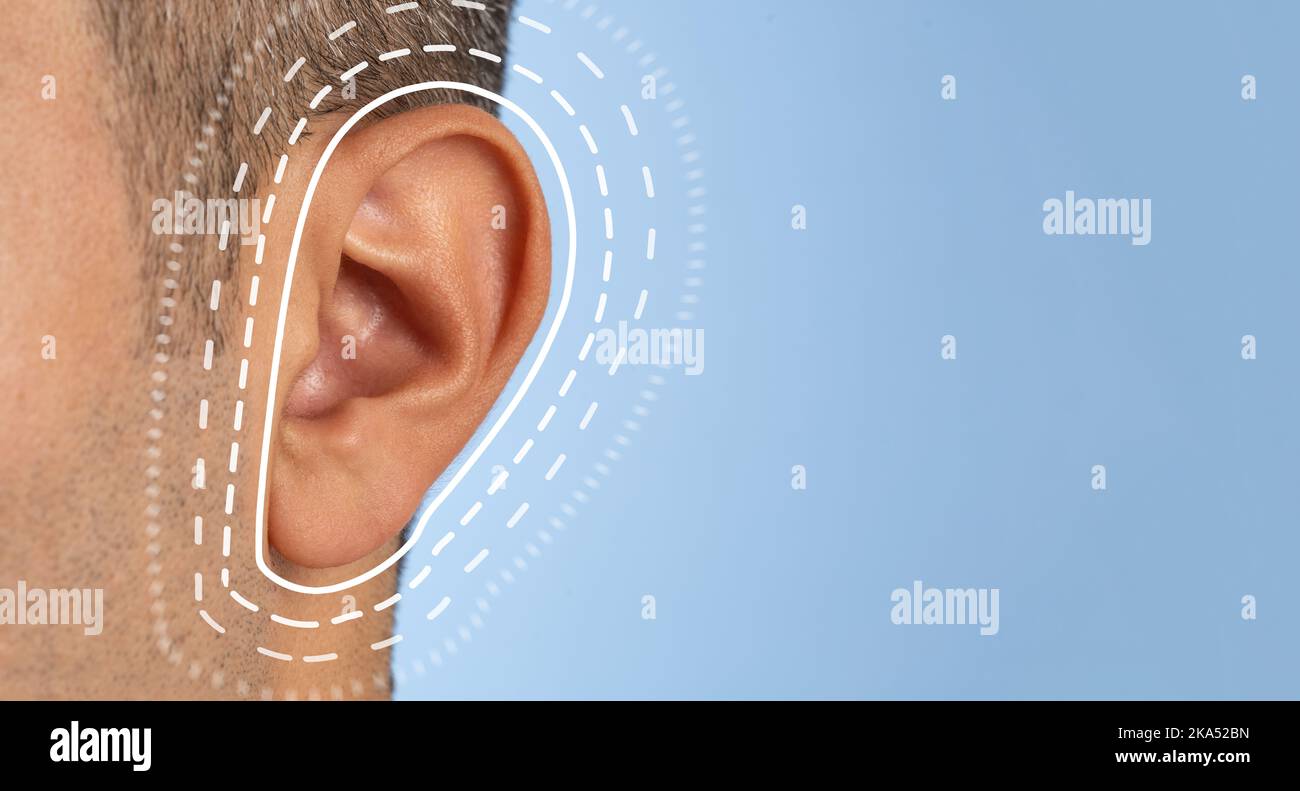Nahaufnahme eines Mannes mit braunem Ohr. Konzept des Hörtests und der Ohrenchirurgie. Stockfoto