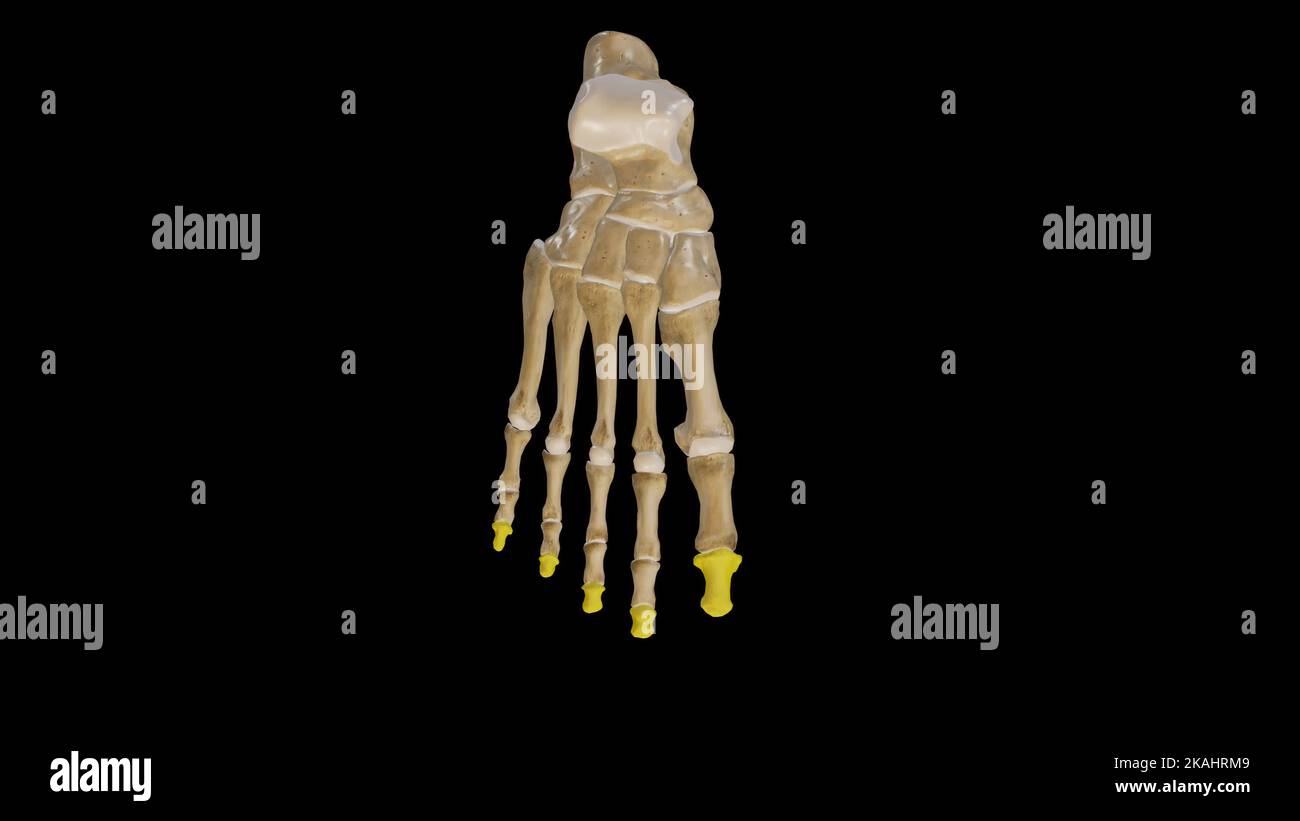 Distaler Phalanges des Fußes Stockfoto