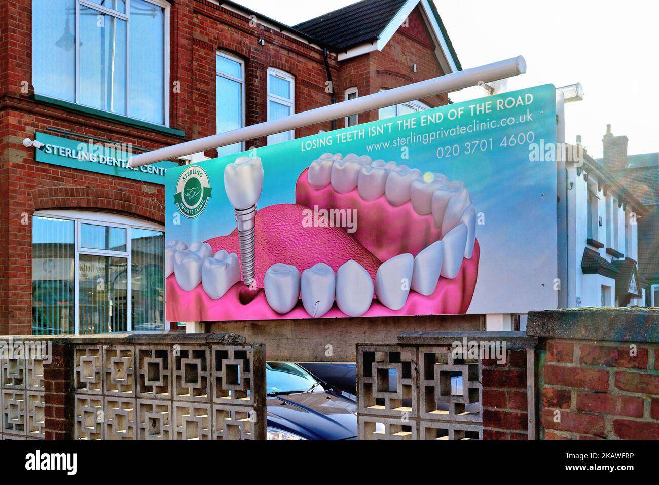 Ein großes Poster mit einem Zahnimplantat außerhalb des Sterling Dental Centers an der South Road Southall Greater London England Stockfoto