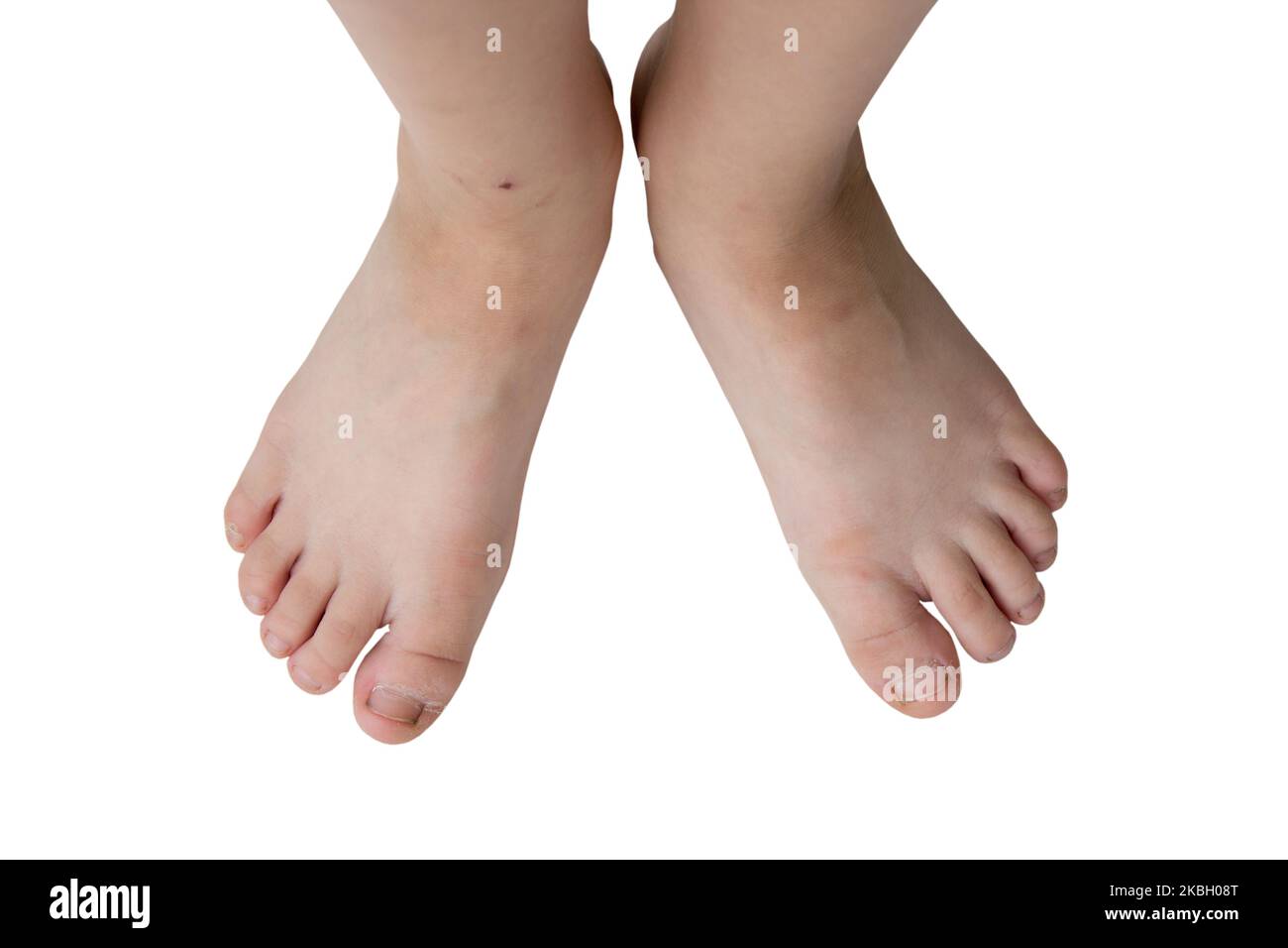 Füße eines Kindes 7 Jahre auf weißem Hintergrund Stockfoto
