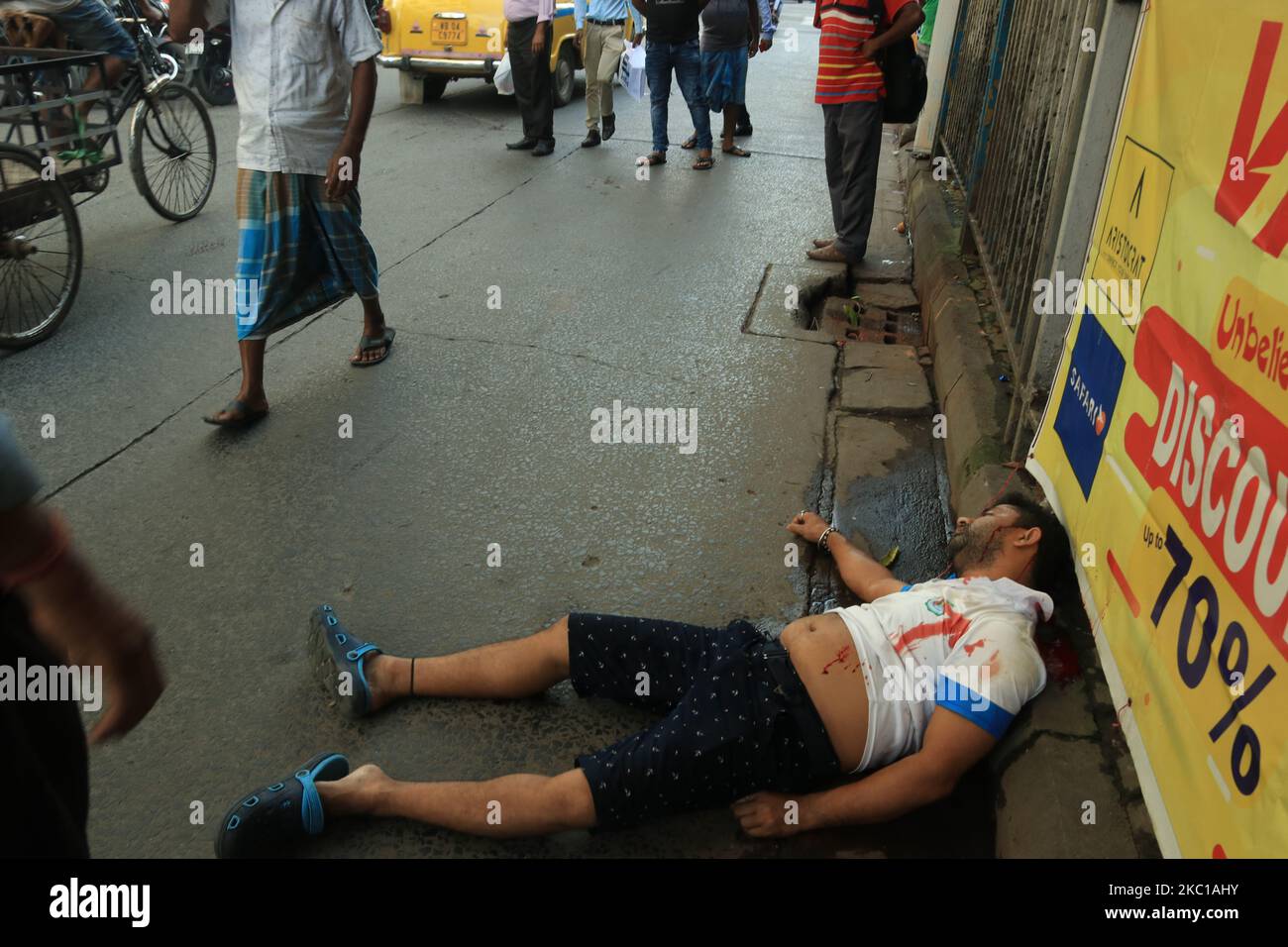 (HINWEIS DER REDAKTION: Das Bild enthält grafische Inhalte.) Ein Straßenunfall von Männern am 7,2020. Oktober in Kalkutta schwer verletzt (Foto: Debajyoti Chakraborty/NurPhoto) Stockfoto