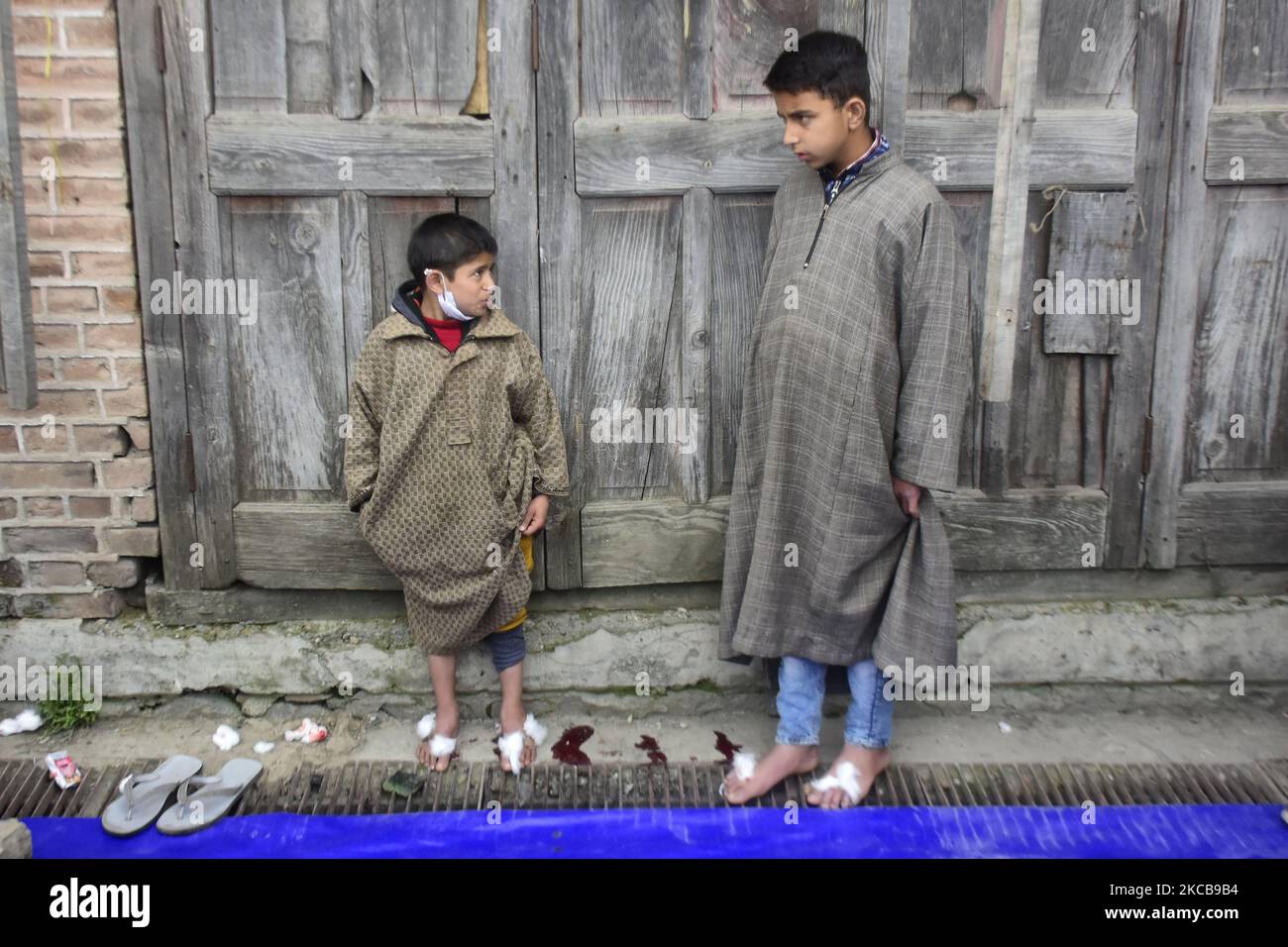 Kashmiri-Jungen nehmen am Vorabend des Nauroz (persisches Neujahr) in Srinagar, dem indischen Kaschmir, am 21. März 2021 eine lech-Therapie in der Region bekannt als „Derkhe Illaaj“ ist eine der ältesten komplementären Therapien, die von Kashmir zur Behandlung verschiedener Krankheiten wie Hautkrankheiten, Arthritis, chronischen Kopfschmerzen, Erfrierungen und Sinusitis. (Foto von Muzamil Mattoo/NurPhoto) Stockfoto