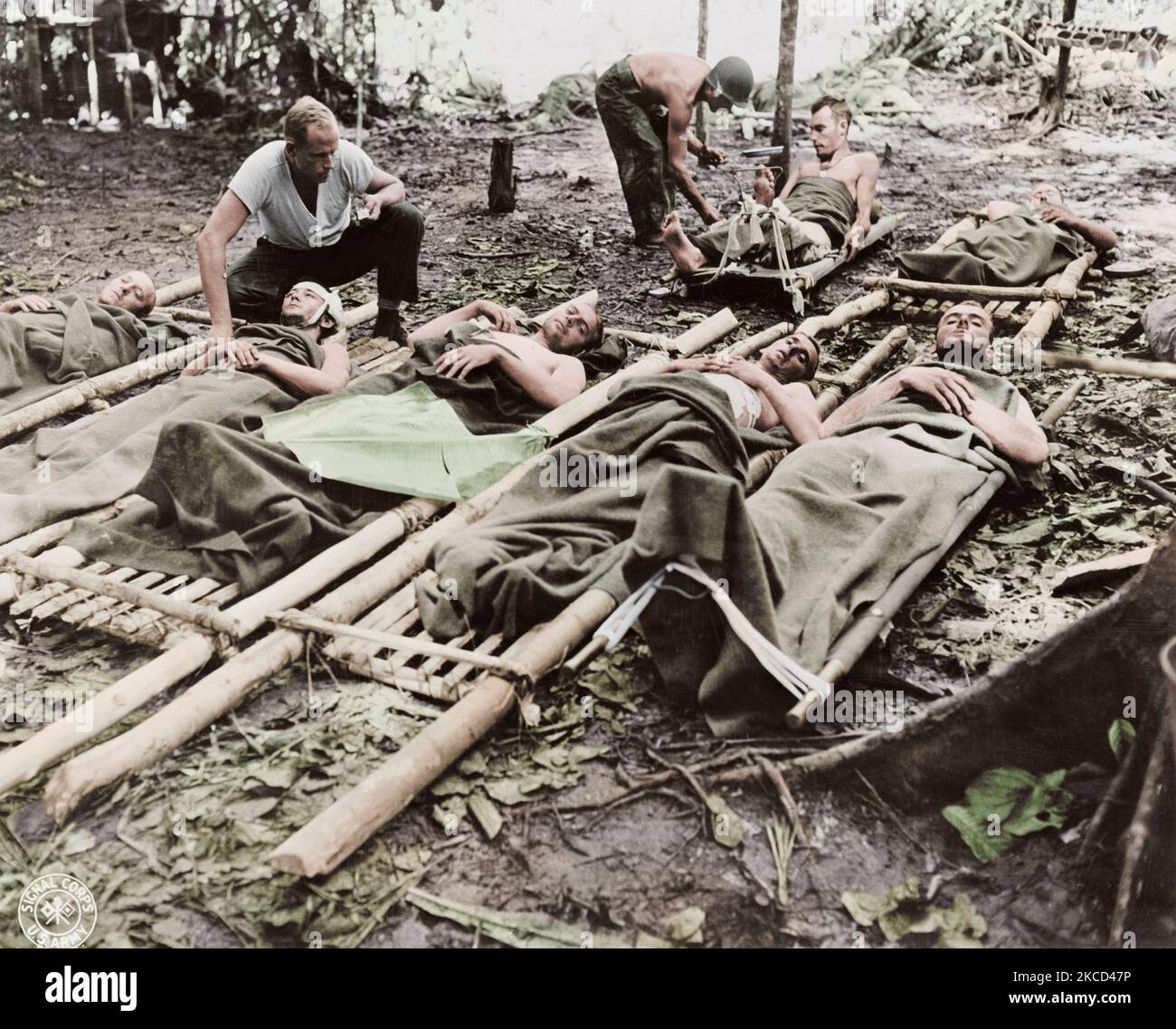Verwundete amerikanische Soldaten gegeben, ärztliche Hilfe in Neu-Guinea, ca. 1942-1945. Stockfoto
