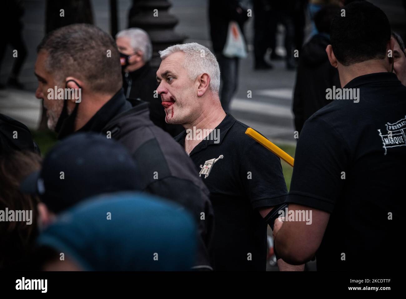 Ein Mitglied des CGT-Sicherheitsdienstes wurde im Gesicht verletzt, nachdem Antifa-Kämpfer am Ende der Demonstration ihren marsch angegriffen hatten. Die traditionelle Maidemonstration in Paris versammelte mehrere Tausend Menschen, um trotz der derzeit geltenden Gesundheitsbeschränkungen zwischen dem Place de la Républiques und dem Place de la Nation zu marschieren, nachdem die wichtigsten Gewerkschaften (CGT, FO, FSU, Solidarires...) dazu aufrufend waren. Die Demonstration wurde schnell durch Gewalt zwischen dem schwarzen Block und der Polizei getrübt. (Foto von Samuel Boivin/NurPhoto) Stockfoto