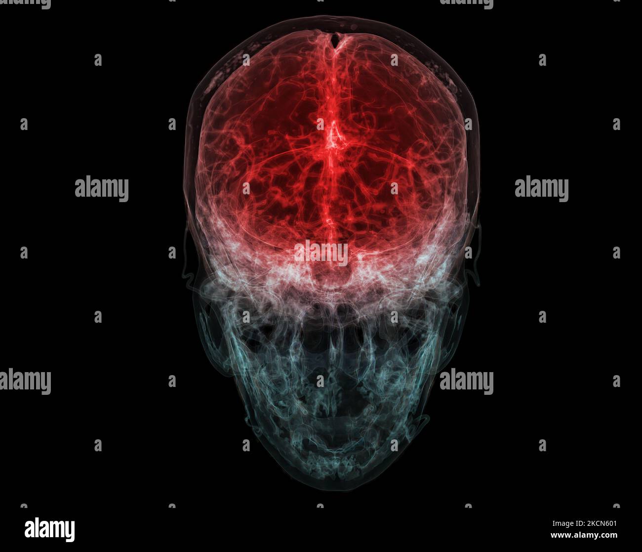 3D medizinisch akkurate Darstellung der Hirnarterie des Kopfes Stockfoto