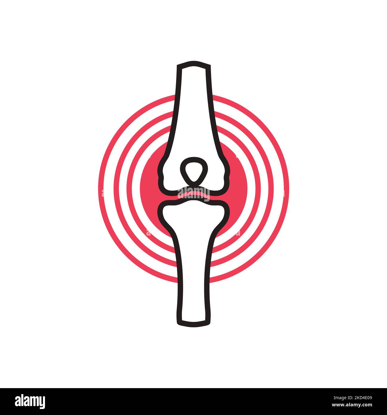 Arthritis, konzeptionelle Illustration Stockfoto