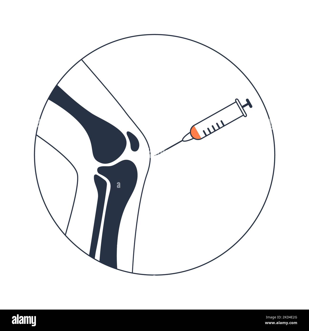 PRP-Kniebehandlung, konzeptionelle Illustration Stockfoto