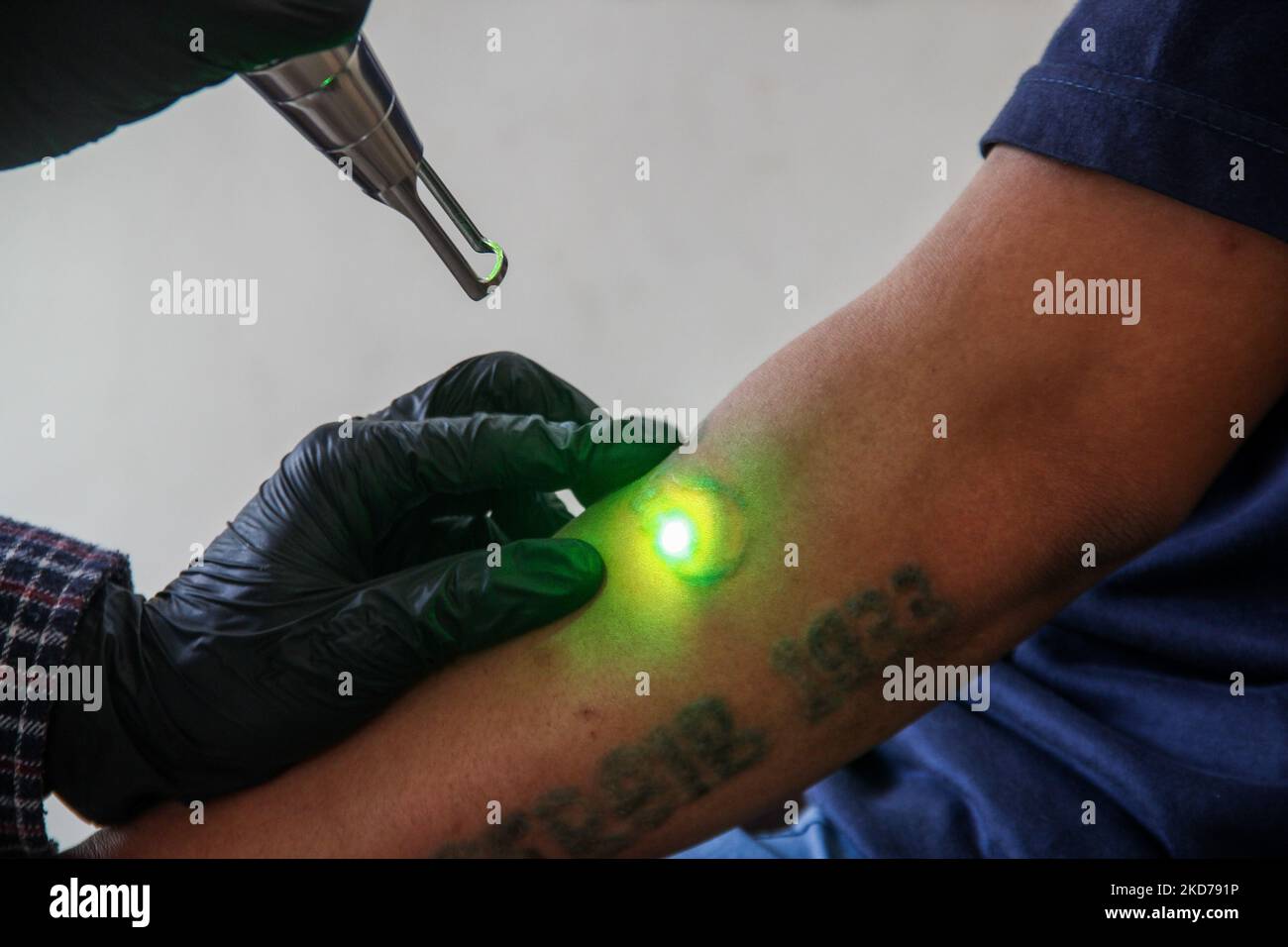 Denny Kurniawan von Hijrah Care sieht, wie sie die Tattoos der Teilnehmer mit einem Lasergerät während eines kostenlosen Tätowierungsprogramms am 10. April 2022 in der Al Latiif Moschee, Bandung City, Indonesien, entfernt. Im Heiligen Monat Ramadan veranstaltete Hijrah Care in Zusammenarbeit mit dem Familienrat der Al Latiif Moschee (DKM) ein kostenloses Tätowierungsprogramm mit insgesamt rund 40 Teilnehmern. (Foto von Algi Febri Sugita/NurPhoto) Stockfoto