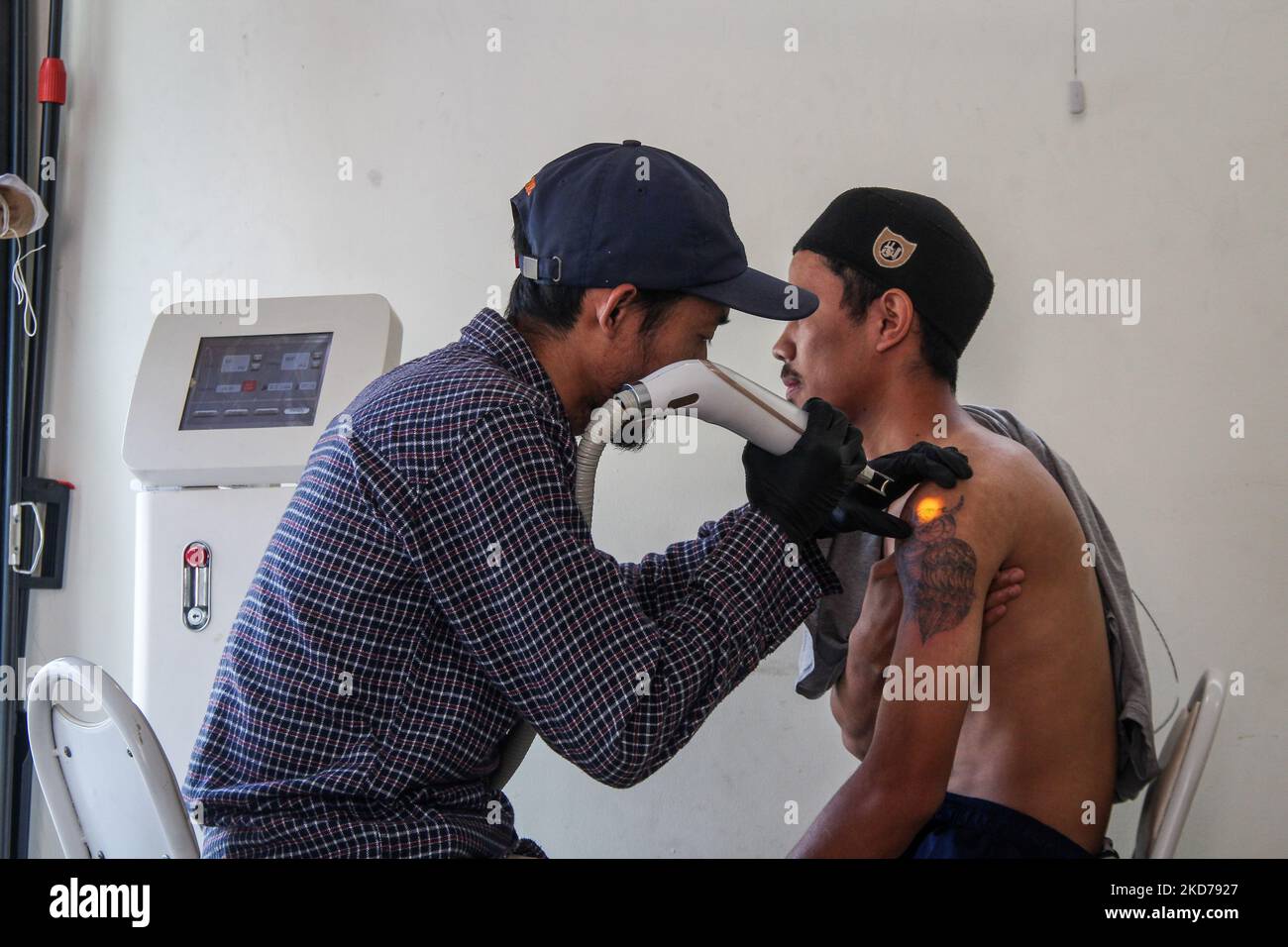 Denny Kurniawan von Hijrah Care sieht, wie er am 10. April 2022 in der Al Latiif Moschee, Bandung City, Indonesien, Tätowierungen mit einem Lasergerät entfernt. Im Heiligen Monat Ramadan veranstaltete Hijrah Care in Zusammenarbeit mit dem Familienrat der Al Latiif Moschee (DKM) ein kostenloses Tätowierungsprogramm mit insgesamt rund 40 Teilnehmern. (Foto von Algi Febri Sugita/NurPhoto) Stockfoto