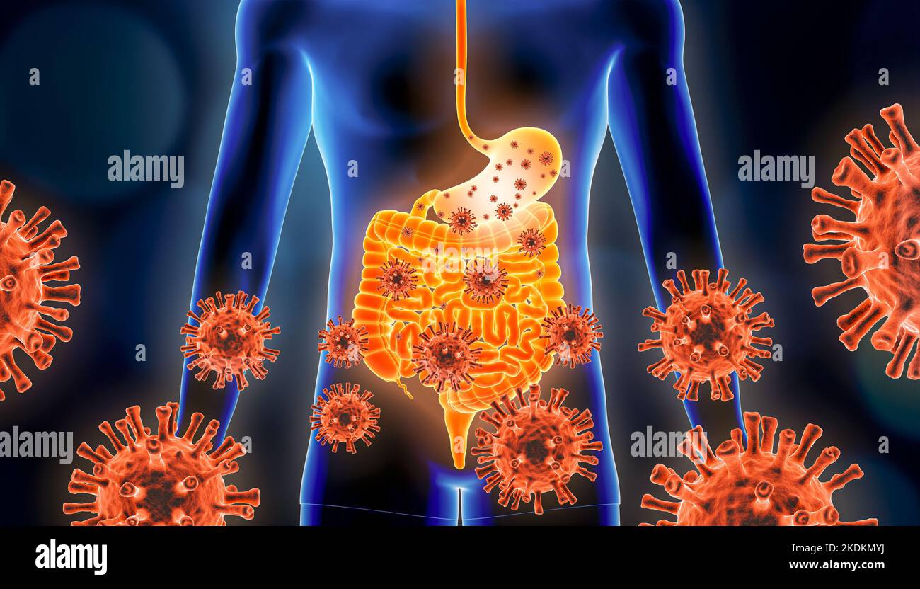 Gastroenteritis der Magengrippe 3D Darstellung mit roten Viruszellen und menschlichen Körper. Virale, infektiöse und entzündliche Magen- oder Gastrointe Stockfoto