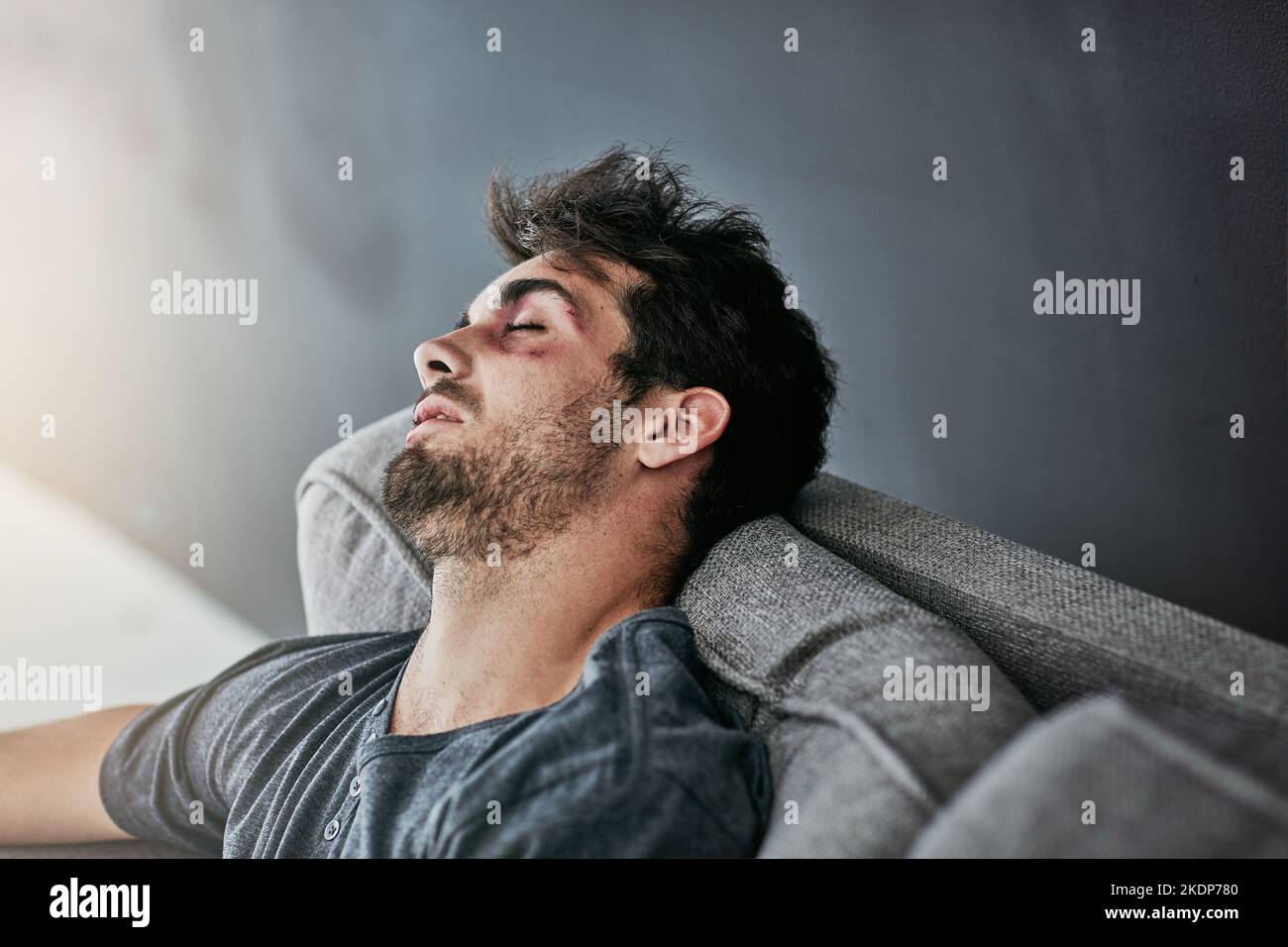 Ein verprügel und zerquetschter junger Mann, der auf dem Sofa schläft. Stockfoto