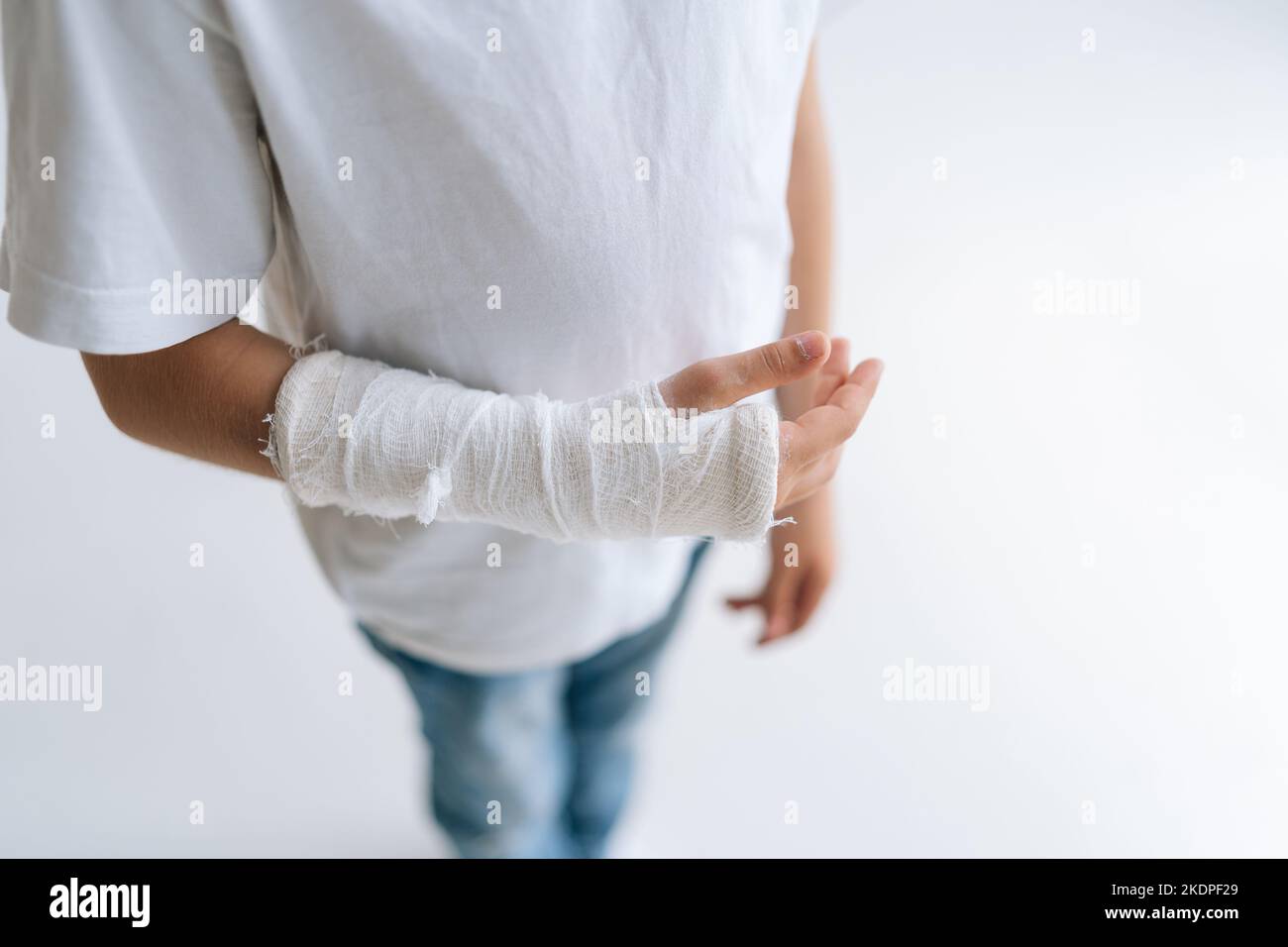 Nahaufnahme eines unerkennbaren kleinen Mädchens mit gebrochener Hand, eingewickelt in einen Gipsverband, das auf einem weißen, isolierten Hintergrund steht. Stockfoto