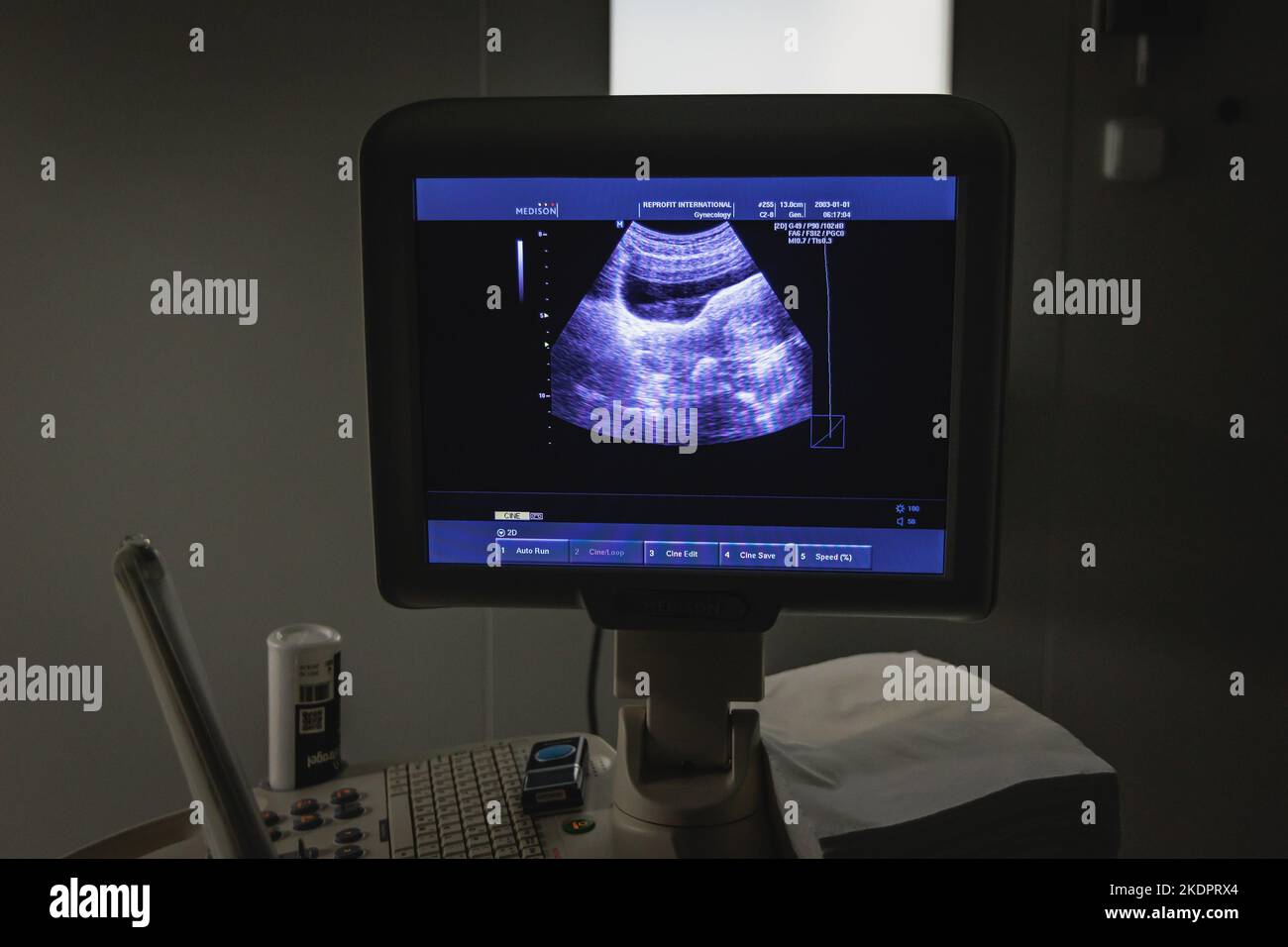 Medizinisches Ultraschallgerät in der Klinik Stockfoto