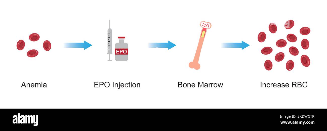 Wissenschaftliche Entwicklung des Erythropoietin-Effekts (EPO) auf den Knochen nach der Injektion. Renale und hepatische Produktion von EPO. Bunte Symbole. Vektordarstellung Stock Vektor