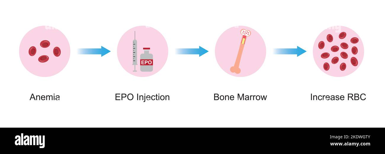 Wissenschaftliche Entwicklung des Erythropoietin-Effekts (EPO) auf den Knochen nach der Injektion. Renale und hepatische Produktion von EPO. Bunte Symbole. Vektordarstellung Stock Vektor