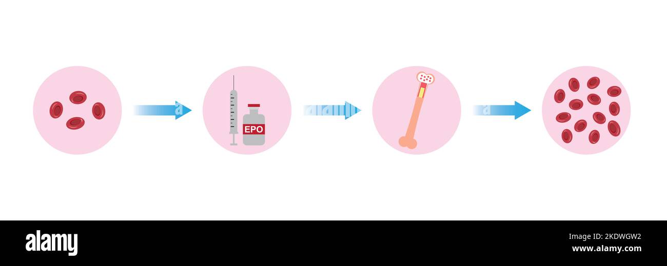 Wissenschaftliche Entwicklung des Erythropoietin-Effekts (EPO) auf den Knochen nach der Injektion. Renale und hepatische Produktion von EPO. Bunte Symbole. Vektordarstellung Stock Vektor