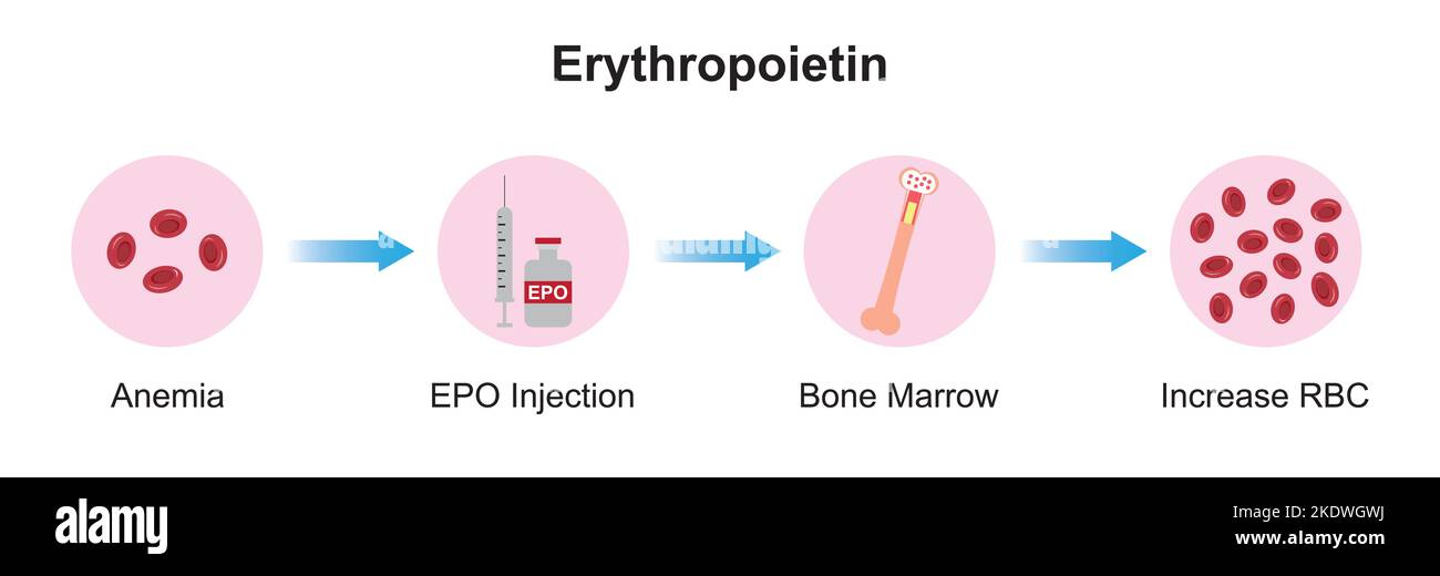 Wissenschaftliche Entwicklung des Erythropoietin-Effekts (EPO) auf den Knochen nach der Injektion. Renale und hepatische Produktion von EPO. Bunte Symbole. Vektordarstellung Stock Vektor