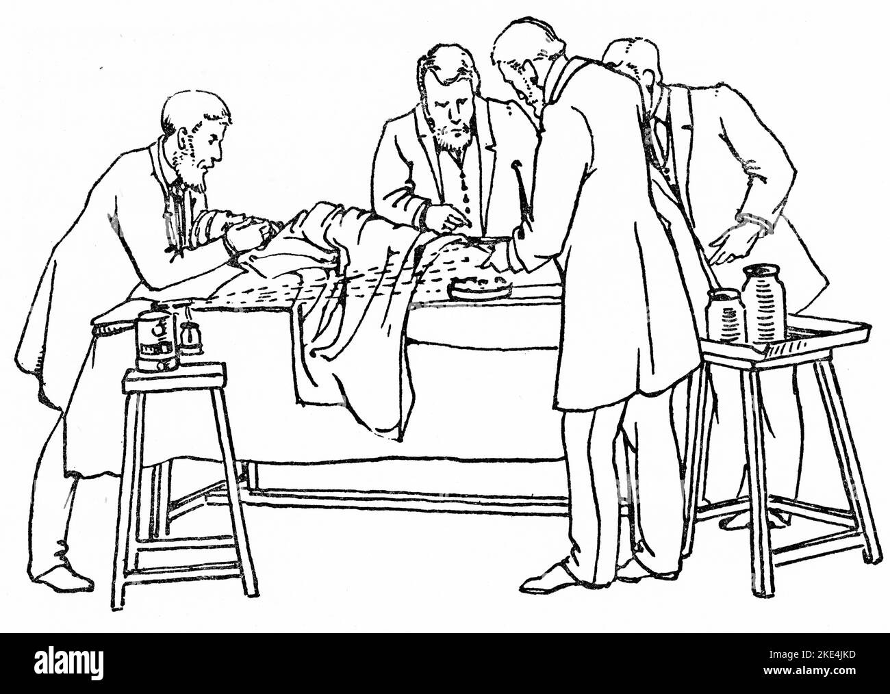 Betrieb von 1880 mit Lister Spray im Einsatz. Der karbolische Dampfsprühapparat von Joseph Lister war ein großer Fortschritt in der antiseptischen Chirurgie und wurde verwendet, um während der Operation eine 5-prozentige karbolische Säurelösung in Operationssälen zu sprühen. Joseph Lister (1827-1912) war ein britischer Chirurg, Medizinwissenschaftler, experimenteller Pathologe und ein Pionier der antiseptischen Chirurgie und Präventivmedizin. Aus „Antiseptische Chirurgie: Seine Prinzipien, Praxis, Geschichte und Ergebnisse“ von William Watson Cheyne (1852-1932). Stockfoto