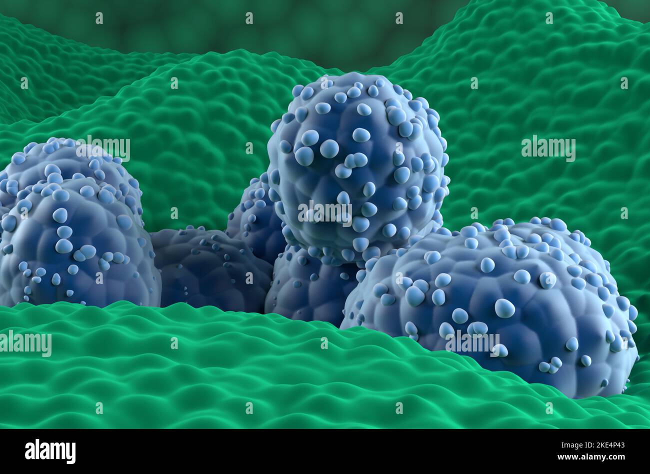Prostatakrebszellen im prostatischen Drüsenepithel - Nahaufnahme Ansicht 3D Abbildung Stockfoto