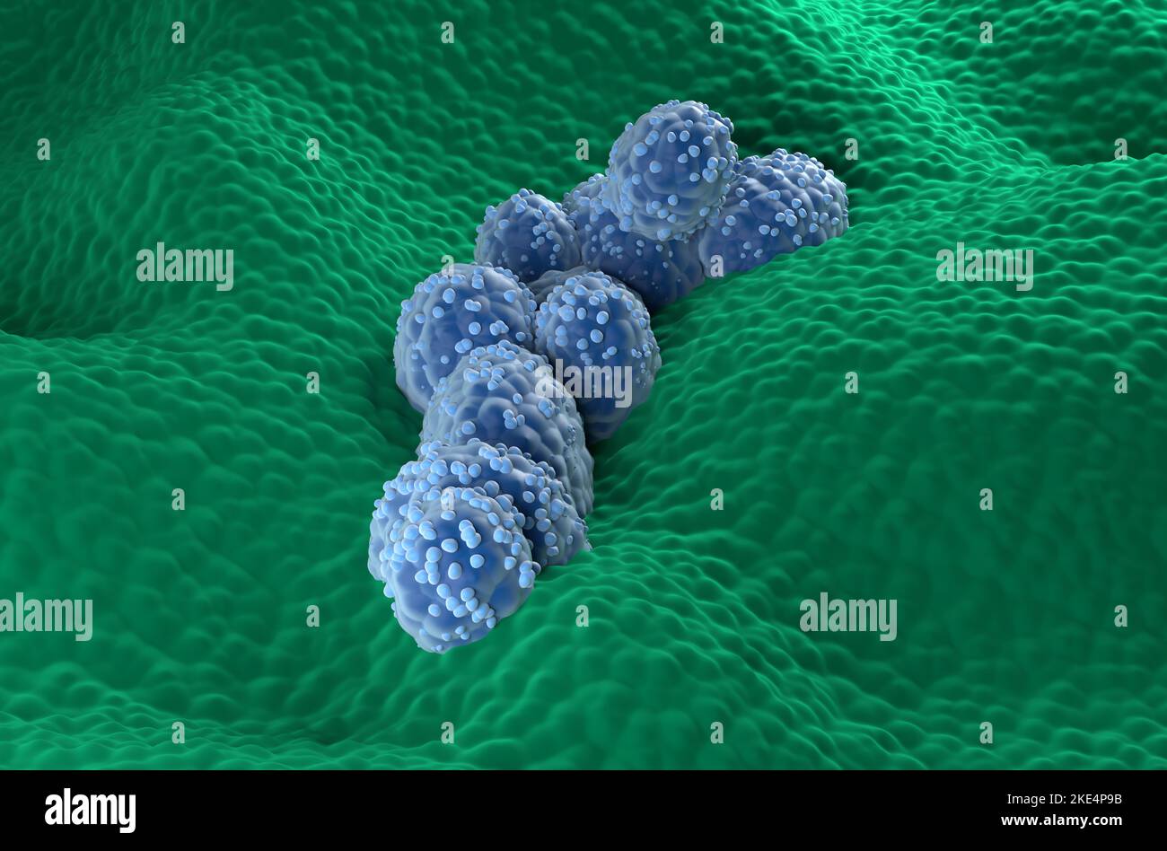 Prostatakrebszellen im prostatischen Drüsenepithel - Vorderansicht 3D Abbildung Stockfoto