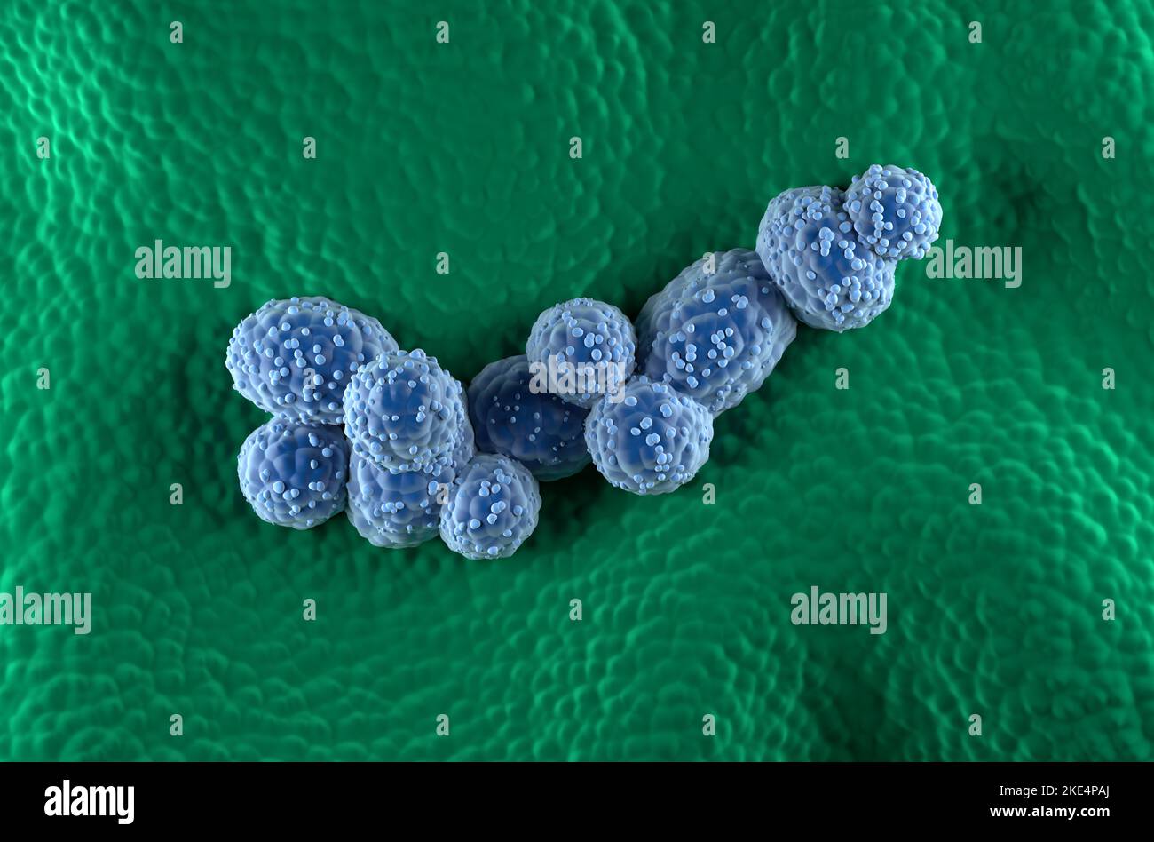Prostatakrebszellen im prostatischen Drüsenepithel - Draufsicht 3D Abbildung Stockfoto