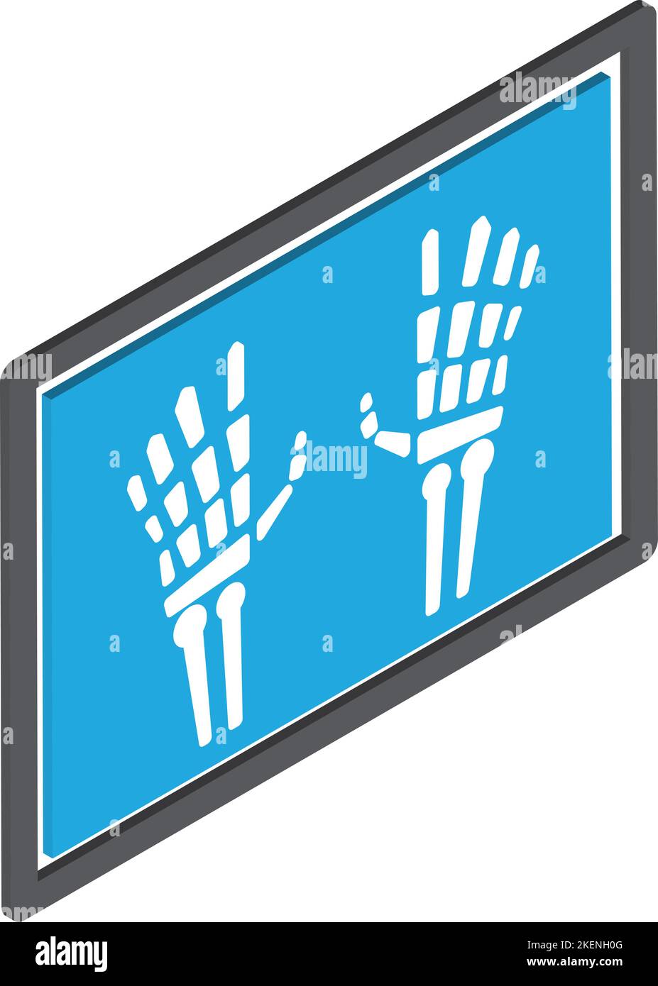 Hand-Röntgendarstellung im isometrischen Stil 3D isoliert auf dem Hintergrund Stock Vektor
