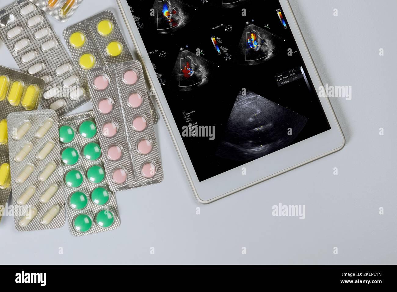 Arzt auf der digitalen Tablette überprüft die Ergebnisse Echokardiographie Ultraschall der Herzuntersuchung, um eine wirksame Behandlung in der medizinischen Praxis zu verschreiben Stockfoto