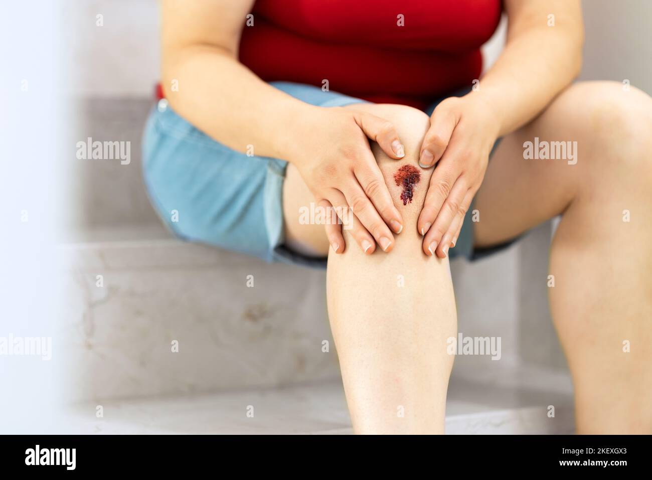 Nahaufnahme der Beine einer Frau, die stolpert und auf eine Blutwunde schaut, die die Treppe hinuntergeht Stockfoto
