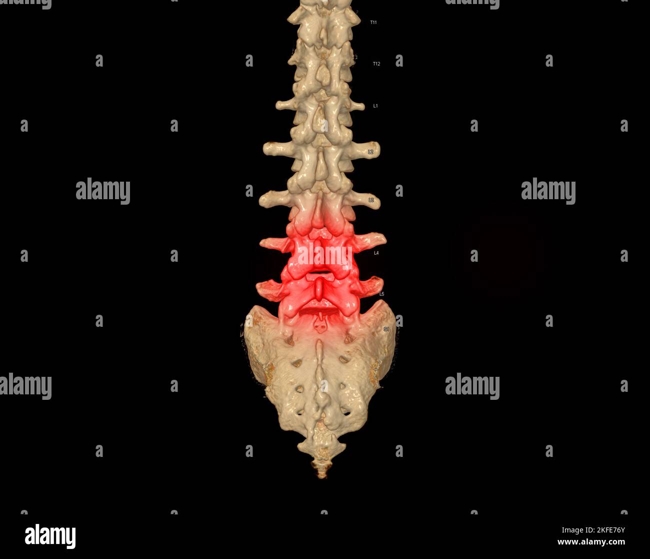 CT-Scan der Lendenwirbelsäule 3D mit Profildarstellung der menschlichen Wirbelsäule. Muskel-Skelett-System Menschlicher Körper. Struktur Der Wirbelsäule. Untersuchung von Problemerkrankungen und Tre Stockfoto