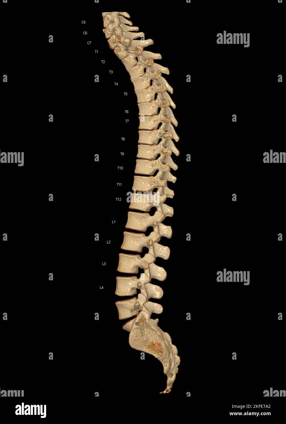 CT-Scan der gesamten Wirbelsäule 3D mit Darstellung der Profilwirbelsäule. Muskel-Skelett-System Menschlicher Körper. Struktur Der Wirbelsäule. Untersuchung von Problemerkrankungen und Trea Stockfoto
