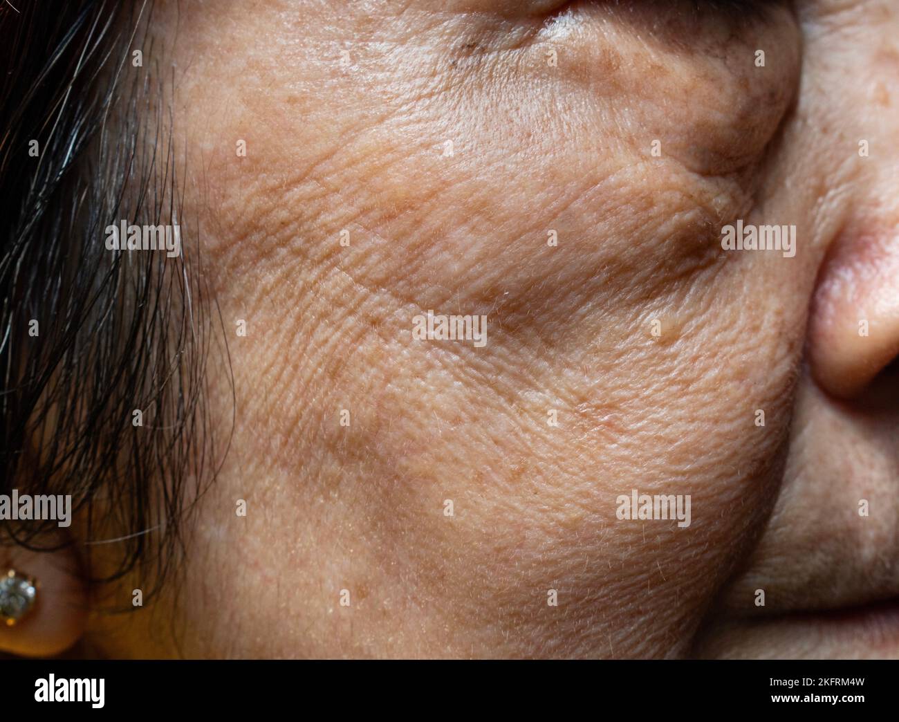 Falten und lockere Haut im Gesicht der südostasiatischen, chinesischen älteren Frau Stockfoto