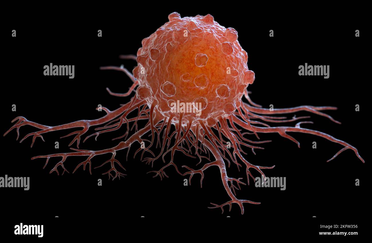 Krebszellen können zu anderen Körpergeweben oder Organen wandern und Metastasen aufbauen. 3D Abbildung Stockfoto