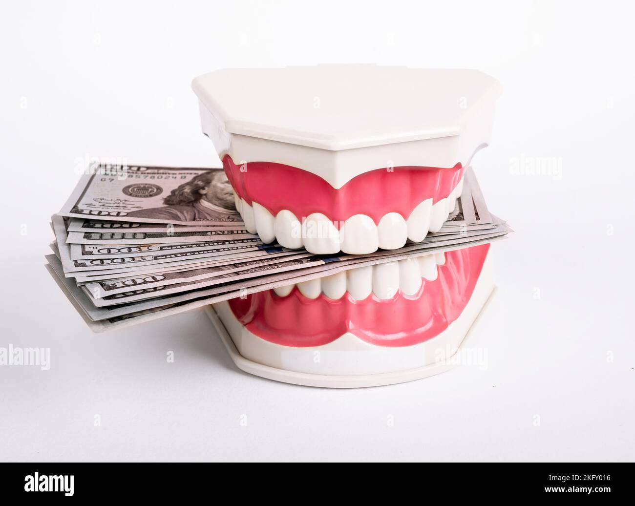 Zähne und Geld. Teures Zahnarztkonzept. Bargeld Dollar im Zahn Kiefer. Hochwertige Fotos Stockfoto