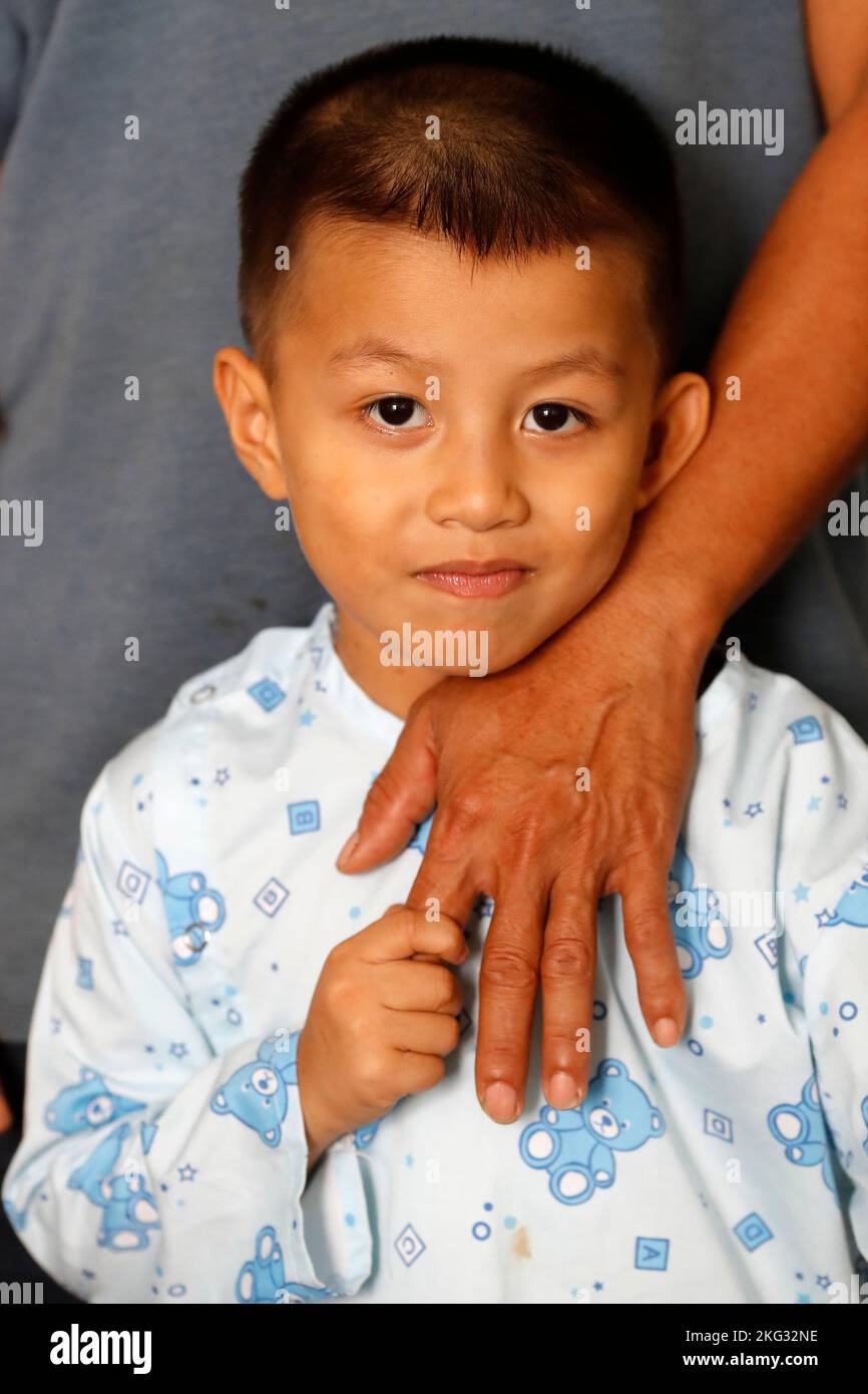 TAM Duc Krankenhaus. Kind mit angeborenem Herzfehler. Ho-Chi-Minh-Stadt. Vietnam. Stockfoto