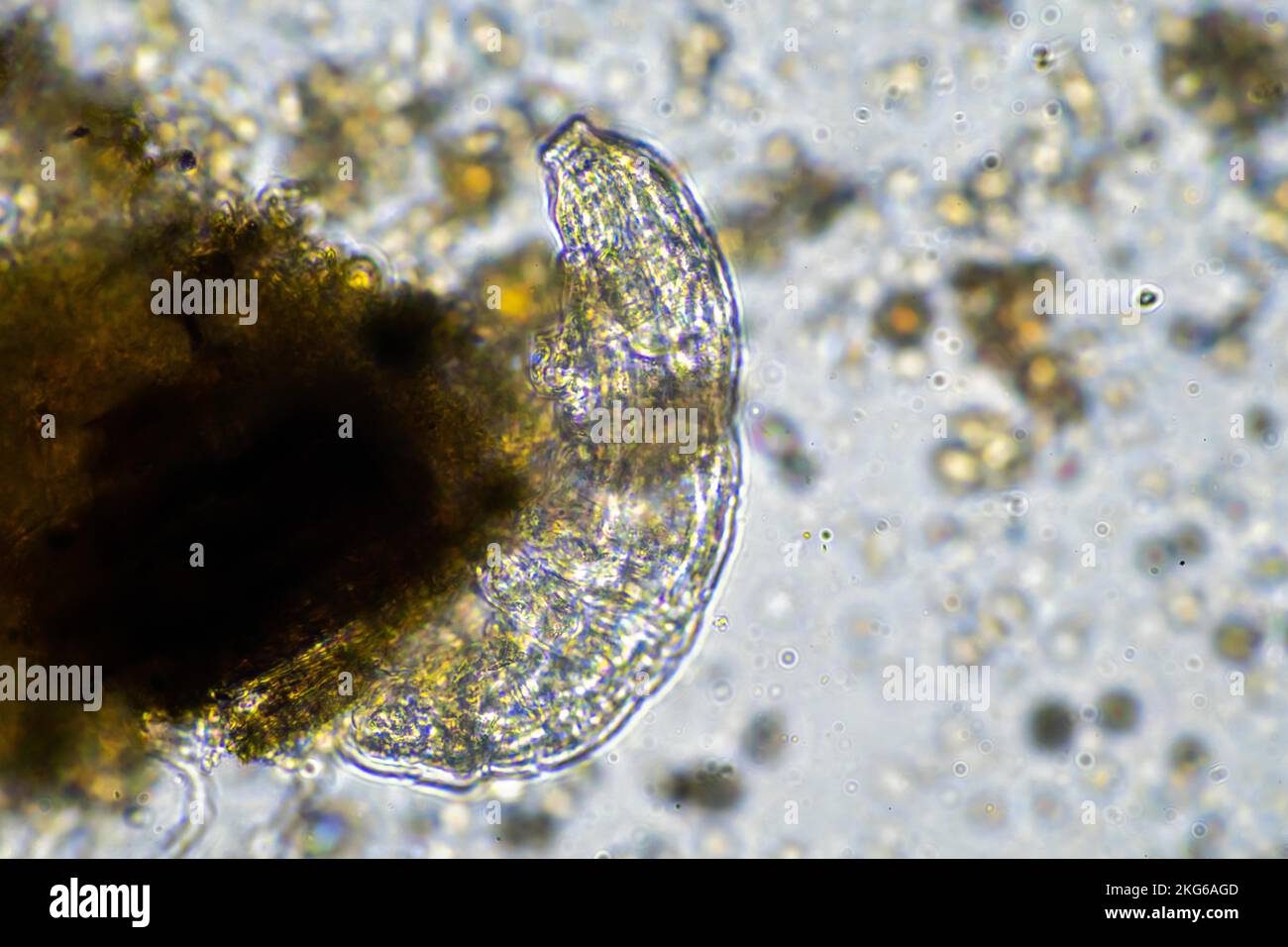 Menschlicher Parasit. Intestinale Infektionskrankheit. Mikroorganismus-Infektion im Krankenhaus beim Menschen Stockfoto