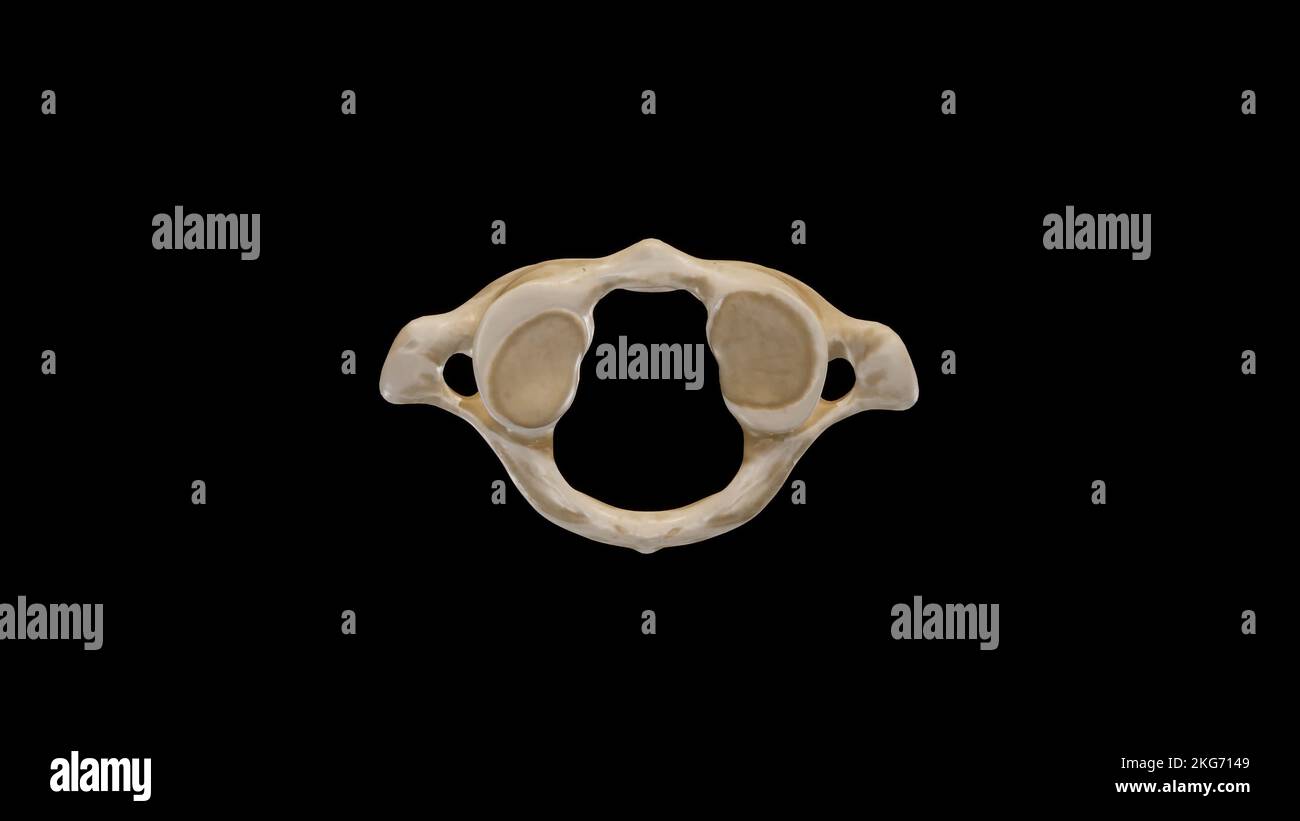 Inferiore Ansicht des ersten Halswirbels (Atlas) Stockfoto