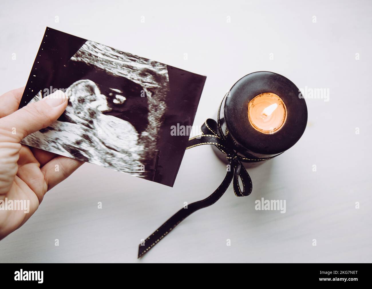 Begriffliches Bild einer trauernden Frau, Fehlgeburt. Mutterhand-Halten-Ultraschallbild des Babys. Schwarze Kerze mit brennendem schwarzen Band. Stockfoto