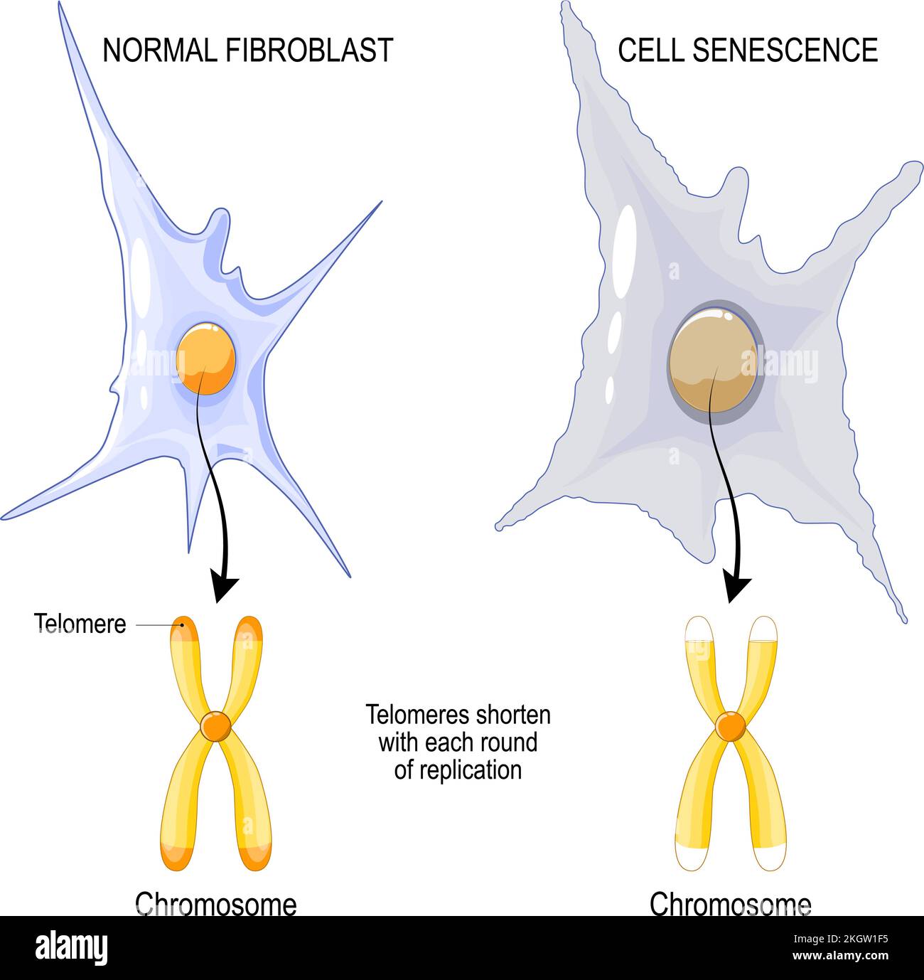 Chromosom eines normalen Fibroblasten und Zellseneszenz. Telomere werden mit jeder Replikationsrunde verkürzt. Alterungsprozess. Vektorposter Stock Vektor