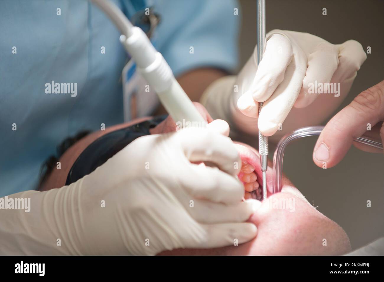 Zahnärztliche Behandlung Stockfoto