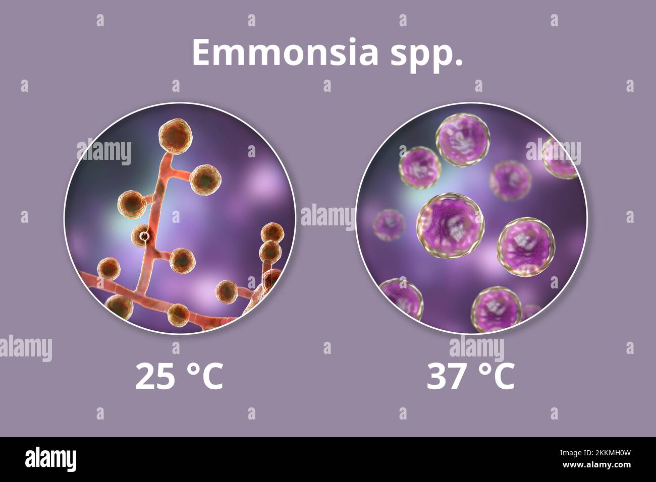Emmonsia-Pilze, Illustration Stockfoto