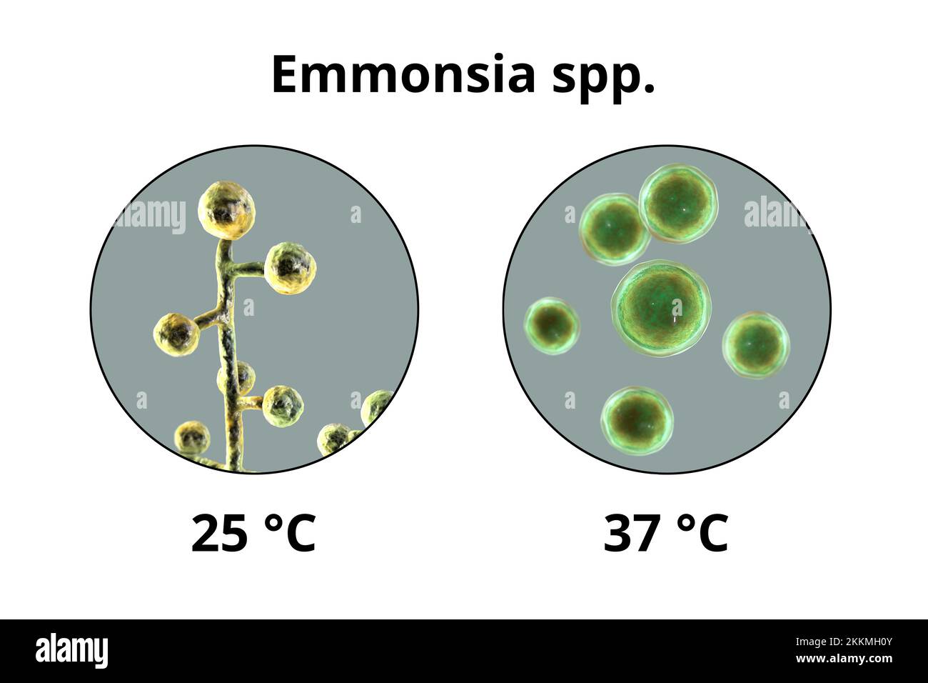 Emmonsia-Pilze, Illustration Stockfoto