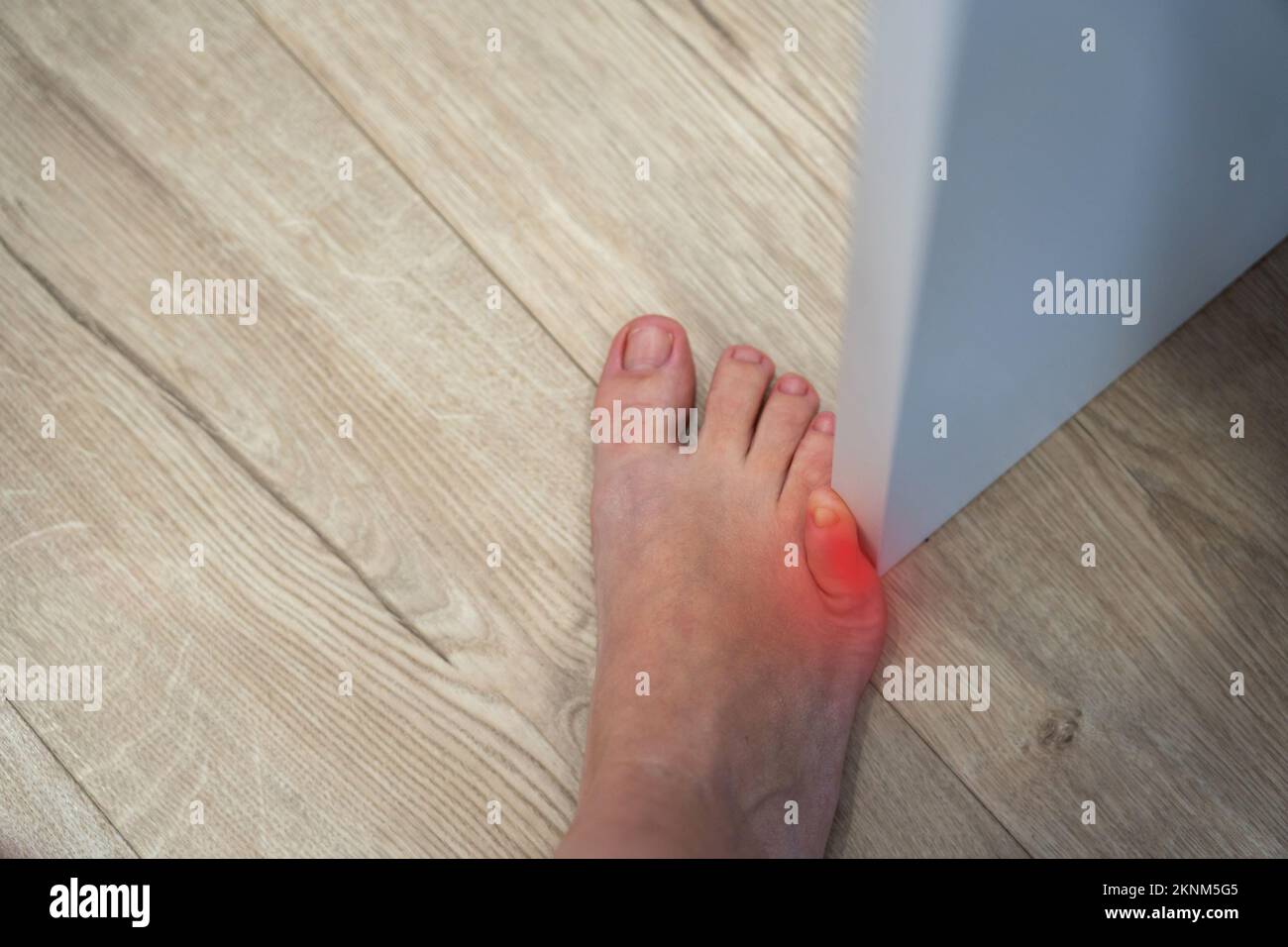 Die Frau hat die Möbel mit dem kleinen Zeh getroffen. Vorfall zu Hause. Roter Fleck mit Verletzung eines kleinen Fußfingers Stockfoto