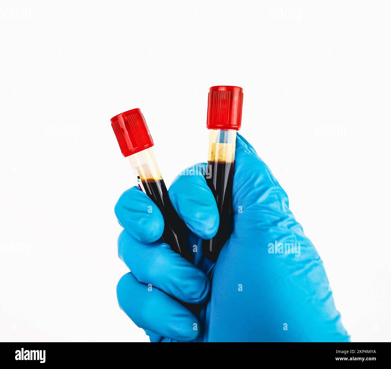 Ein Blutentnahmeröhrchen mit rotem Verschluss ist in der Hand eines blauhandschuhfarbenen Arztes, Objekt isoliert auf weißem Hintergrund, Hämatologie-Labor im Gesundheitswesen Stockfoto