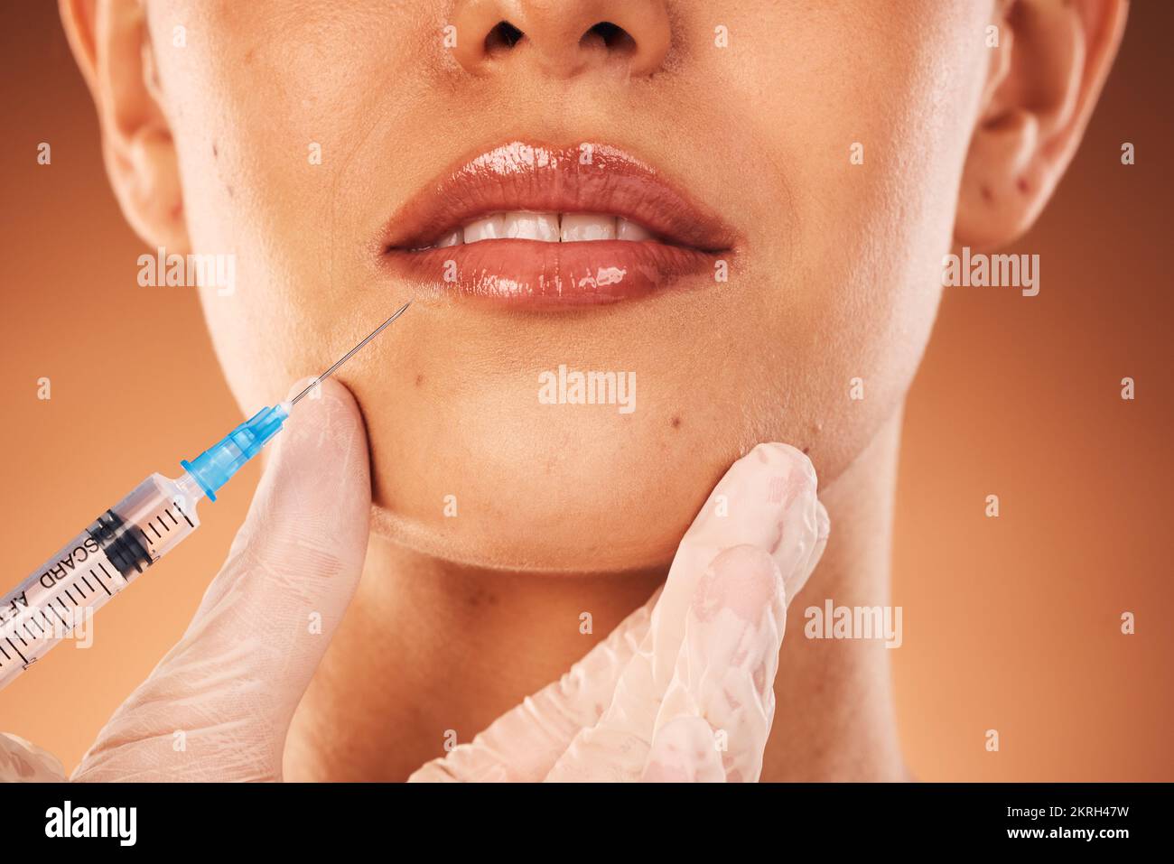 Beauty, Lippen und Botox mit einer Kundin im Studio auf braunem Hintergrund für plastische Chirurgie. Doktor, Vertrauen und Kollagen bei einer Klientin Stockfoto