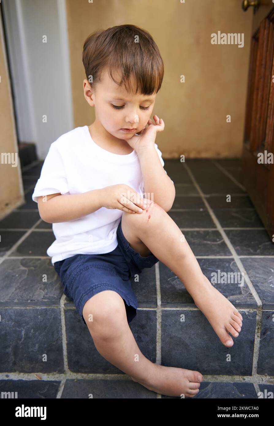 Selbst harte Kerle werden verletzt. Ein süßer kleiner Junge, der auf einer Stufe sitzt und einen Schnitt auf seinem Knie sieht. Stockfoto
