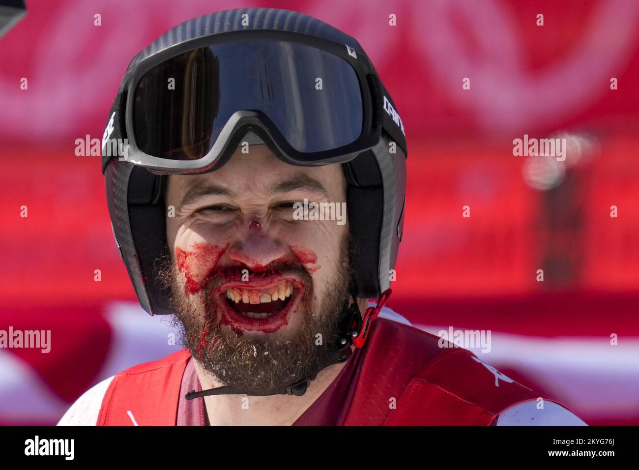 Der österreichische Daniel Hemetsberger hat am Ende des Alpinskilauf Männer Abwärtsrennen im Yanqing National Alpine Skiing Center bei den Olympischen Winterspielen 2022 in Peking am Montag, den 7. Februar 2022 ein blutiges Gesicht. Mayer gewann die Bronzemedaille. Foto: Paul Hanna/UPI Stockfoto
