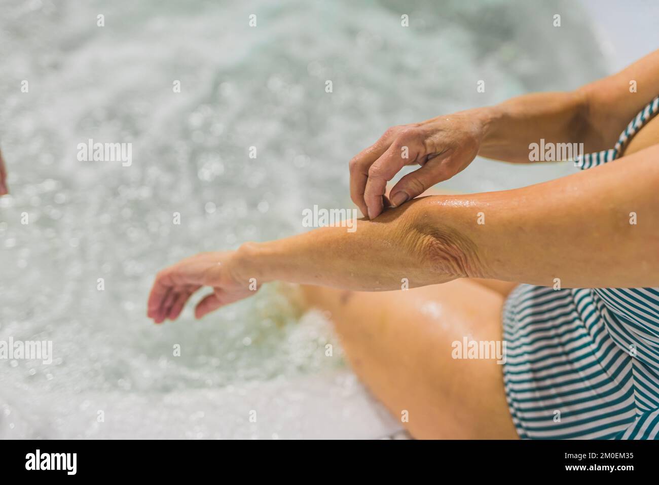 Hautreizkonzept. Nicht wiedererkennbarer weißer Oberbefehlshaber im gestreiften Badeanzug, der seinen Arm zeigt und berührt. Wasser im Hintergrund. Hochwertiges Foto Stockfoto