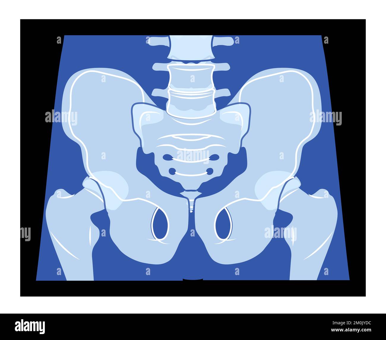 Röntgen Becken Skelett Hüfte menschliche Körperknochen Erwachsene Röntgenfrontansicht. 3D realistisches, flaches blaues Farbkonzept Vektordarstellung der medizinischen Anatomie auf schwarzem Hintergrund isoliert Stock Vektor