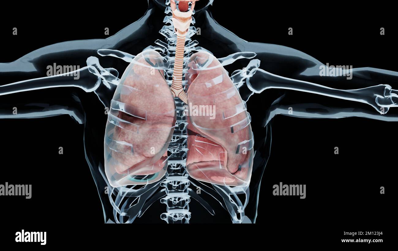 Kollabierte lunge -Fotos und -Bildmaterial in hoher Auflösung – Alamy
