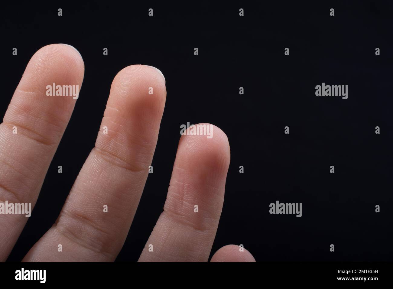 Drei Finger einer Hand des Kindes teilweise in schwarzen Hintergrund gesehen Stockfoto
